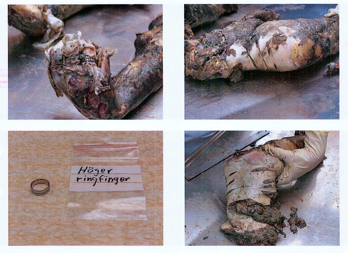 Autopsy images from Christian Larsson case