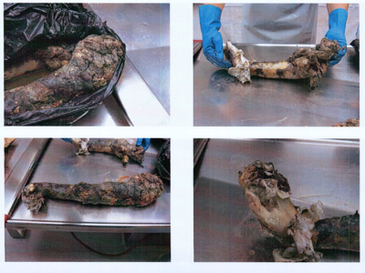 Autopsy images from Christian Larsson case