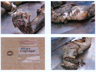 Autopsy images from Christian Larsson case