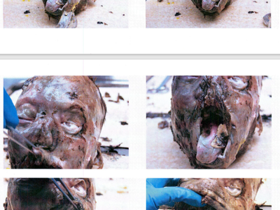 Autopsy images from Christian Larsson case