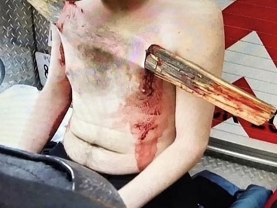 Various horrific injuries and illnesses