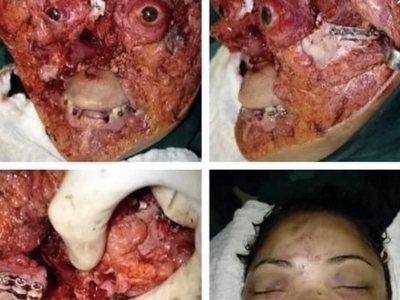 Various horrific injuries and illnesses