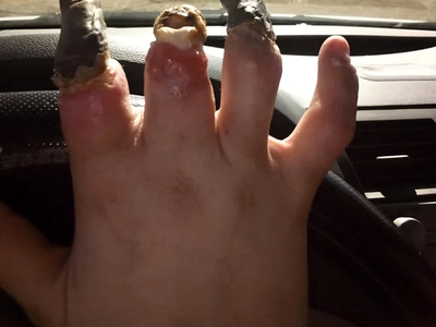 Various horrific injuries and illnesses