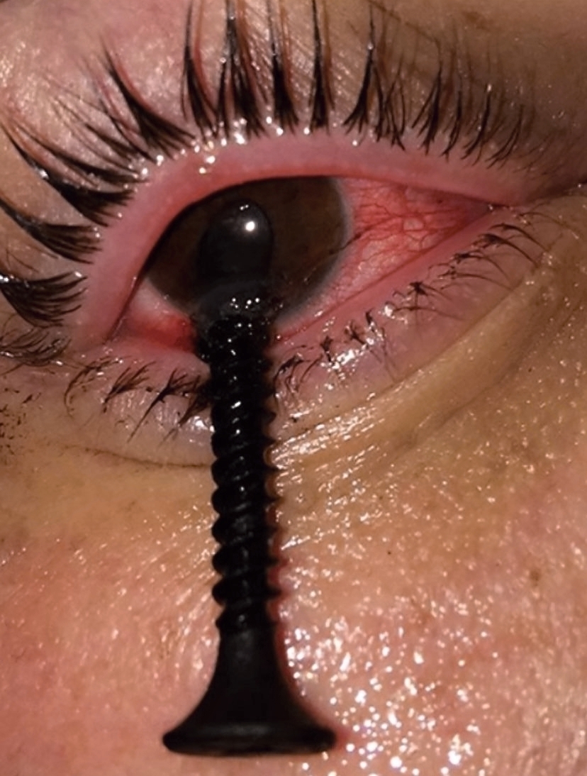 Various injuries and illnesses #2