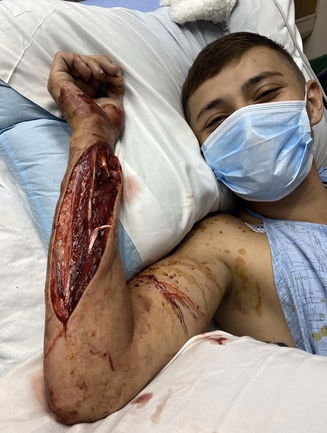 Various injuries and illnesses #3