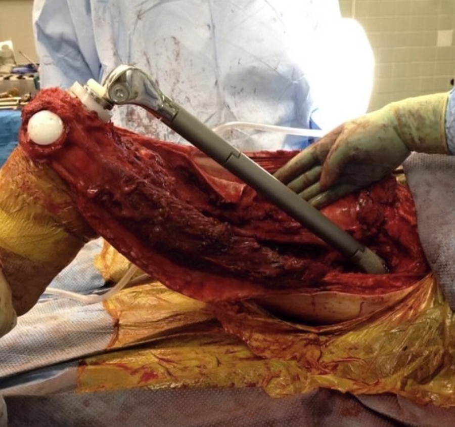 Various injuries and illnesses #3