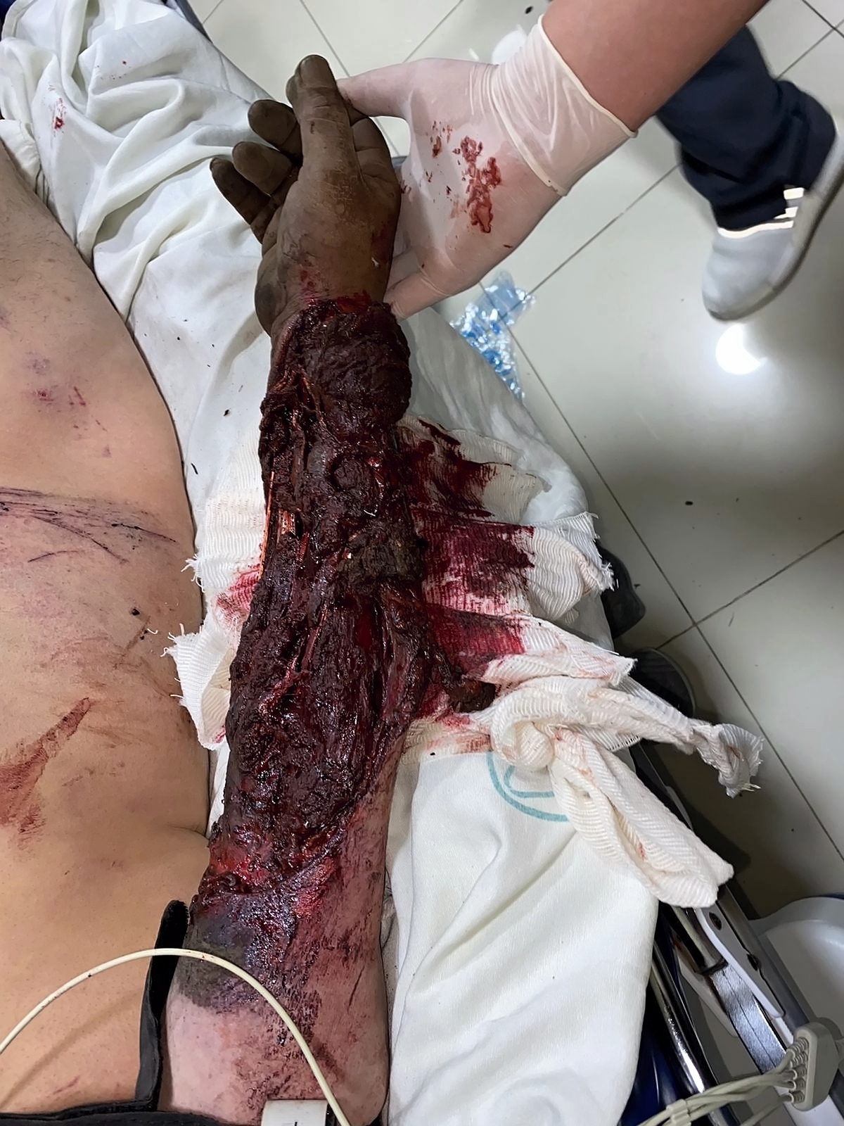 Various injuries and illnesses #3