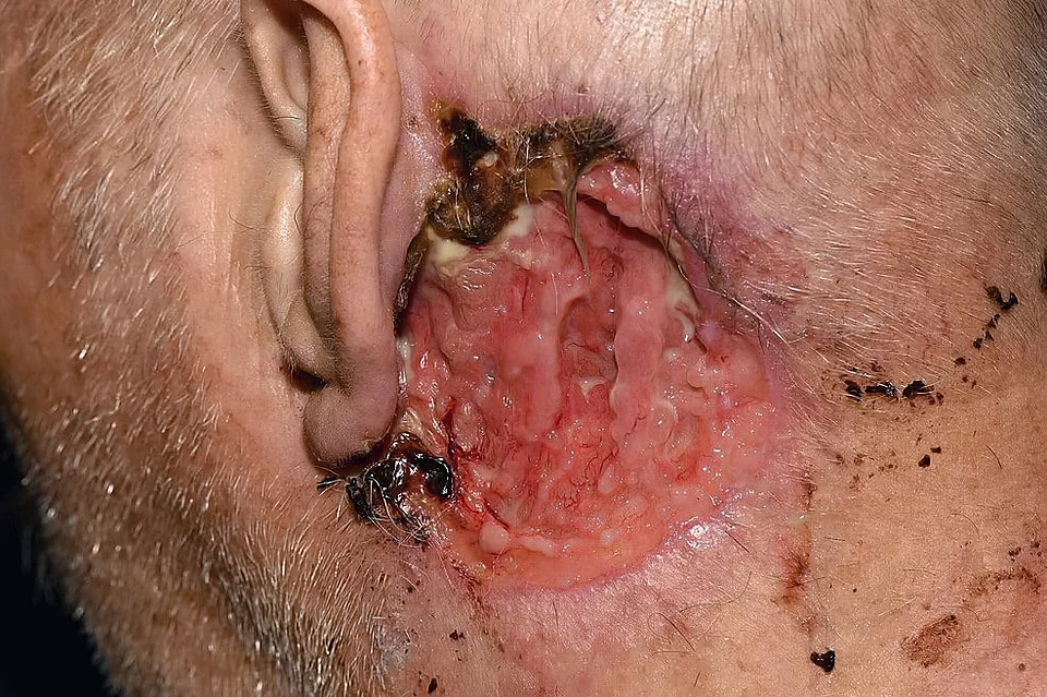 Various injuries and illnesses #3