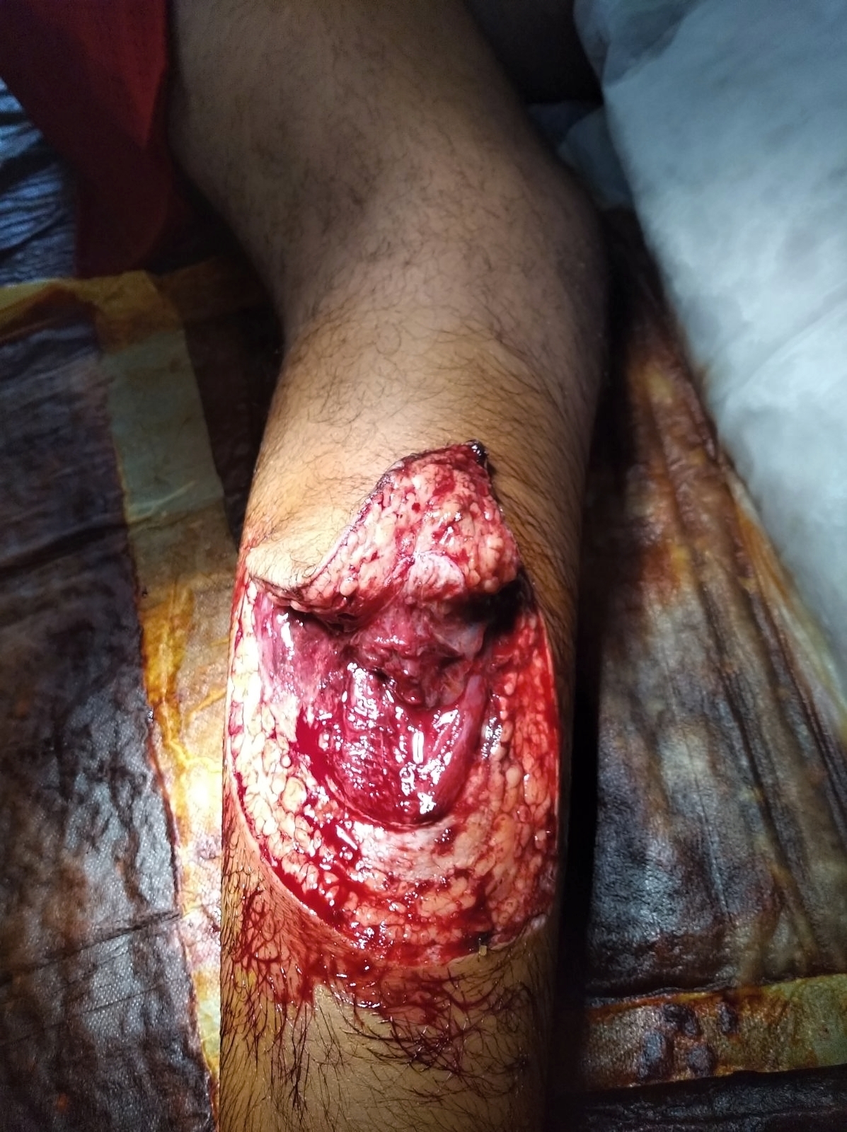 Various injuries and illnesses #3