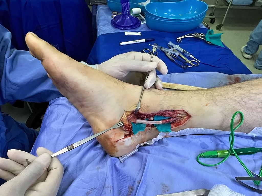 Various injuries and illnesses #3