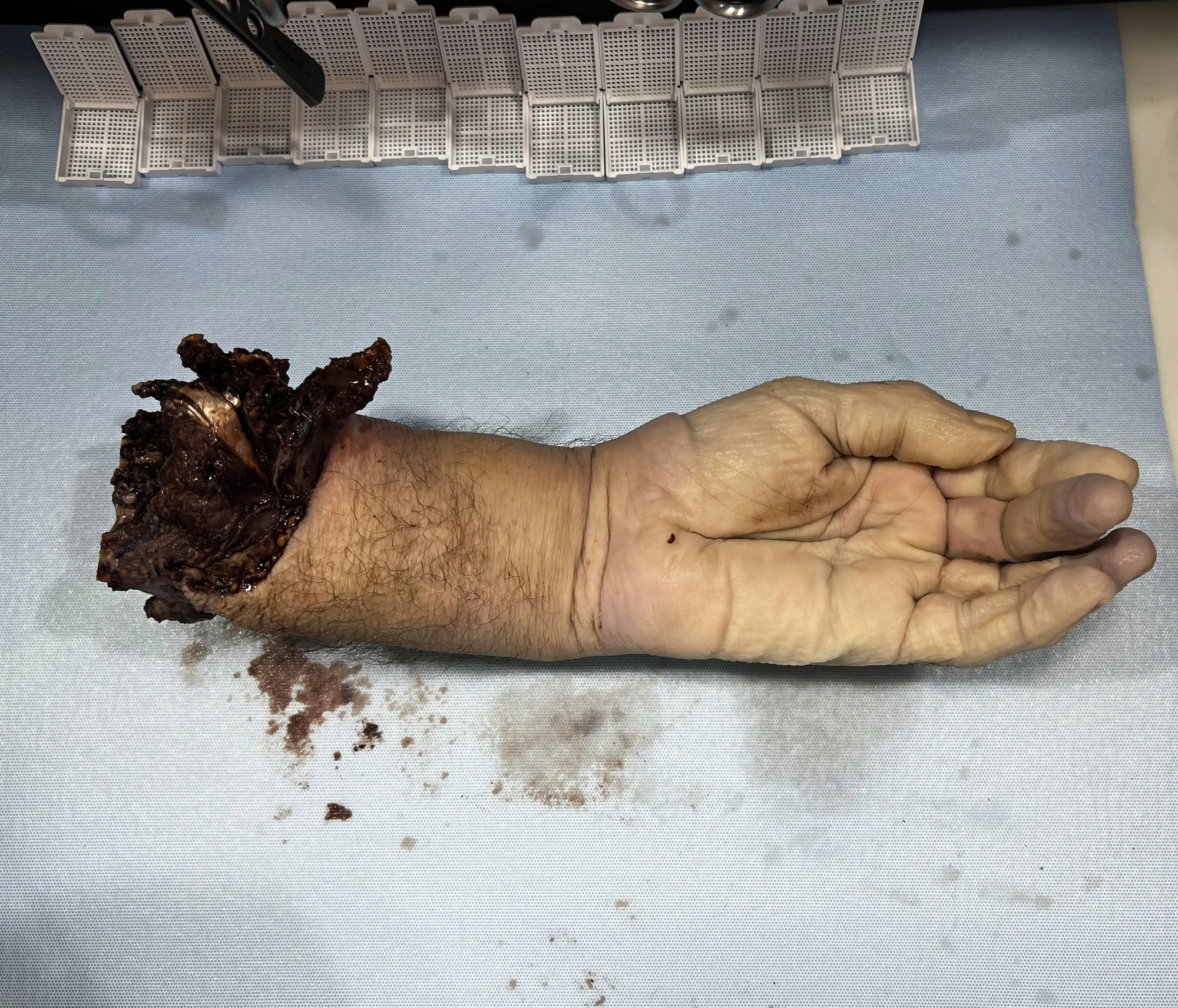 Various injuries and illnesses #3