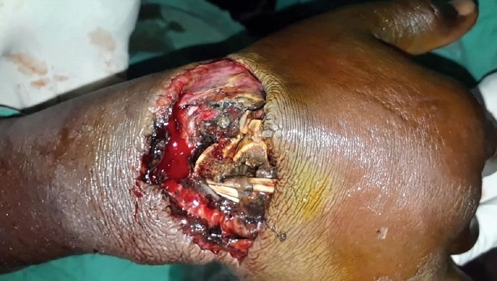 Various injuries and illnesses #3