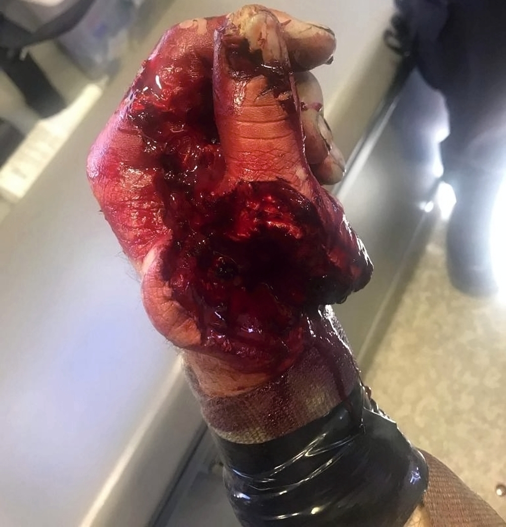 Various injuries and illnesses #3