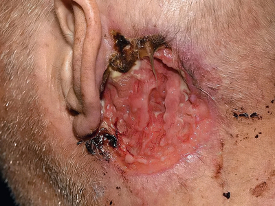 Various injuries and illnesses #2