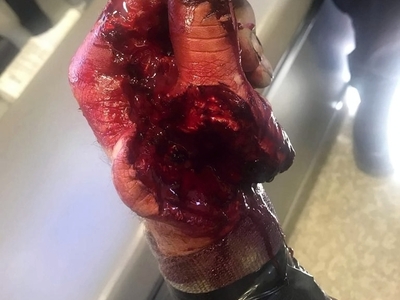 Various injuries and illnesses #3