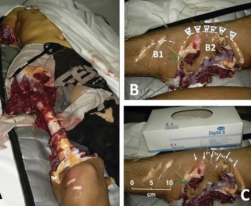 Various injuries and illnesses #IV