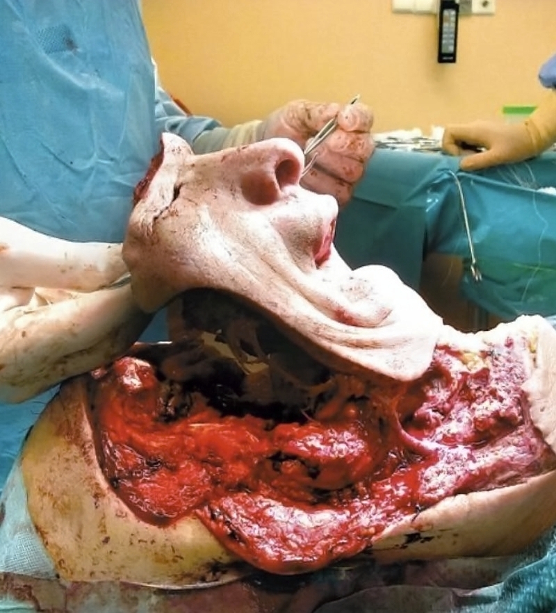 Various injuries and illnesses #IV