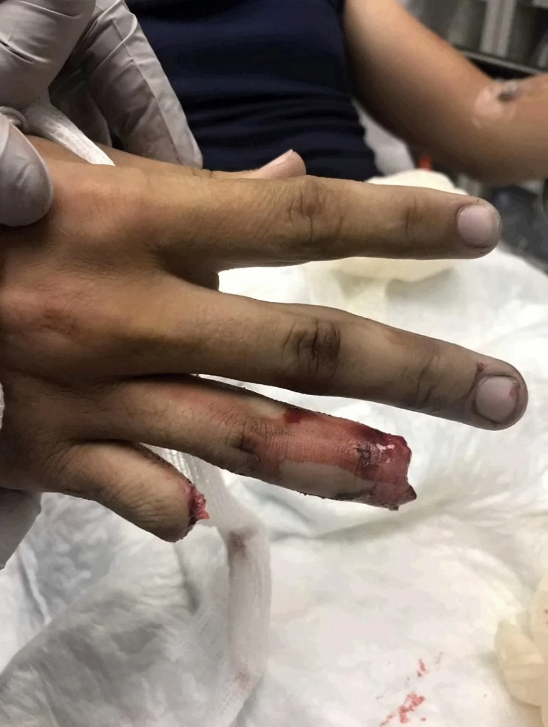 Various injuries and illnesses #IV