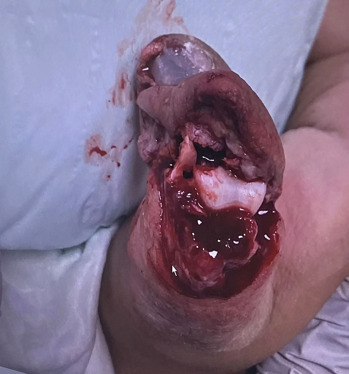 Various injuries and illnesses #IV