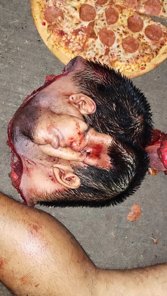 Various injuries and illnesses #IV