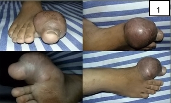 Various injuries and illnesses #IV