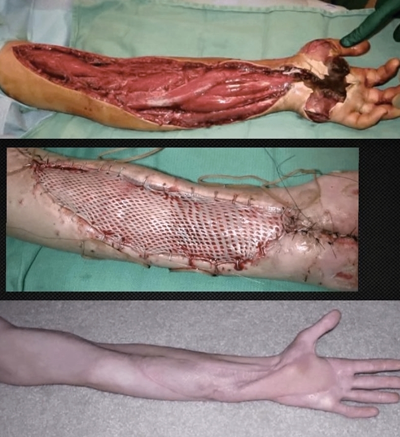 Various injuries and illnesses #IV