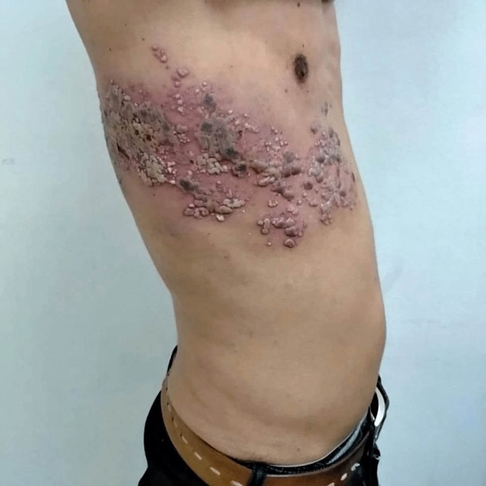 Various injuries and illnesses #IV