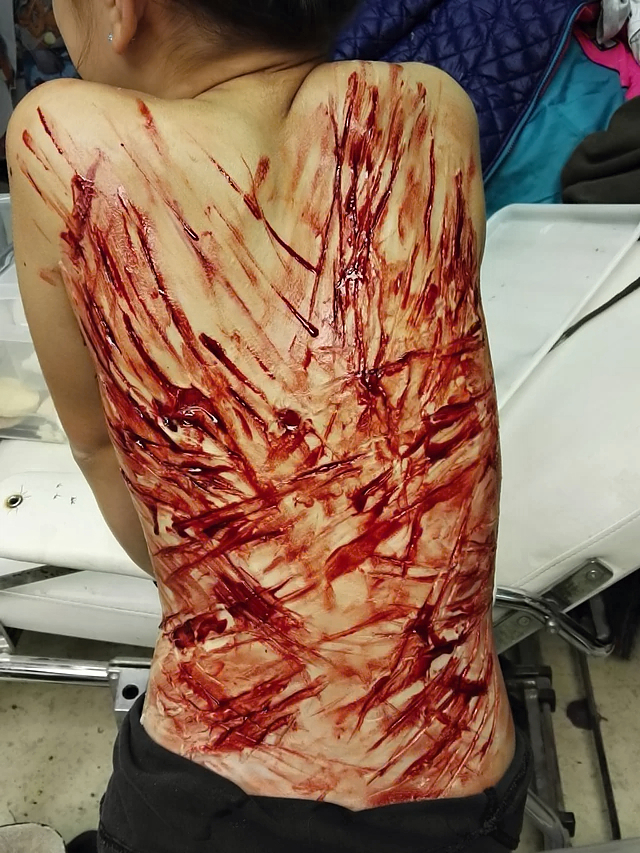 Various injuries and illnesses #IV