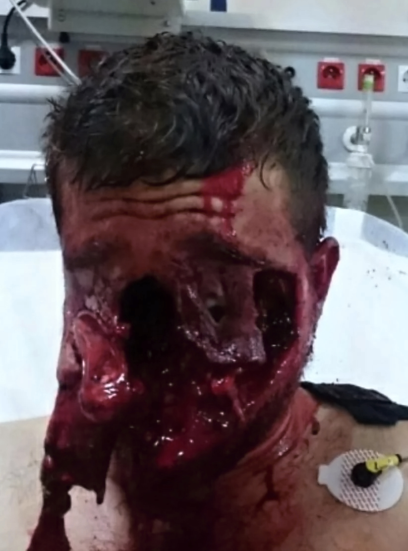 Various injuries and illnesses #IV