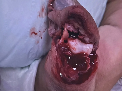 Various injuries and illnesses #IV