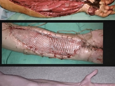 Various injuries and illnesses #IV