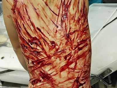 Various injuries and illnesses #IV