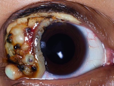 Cheesy AI eyes, UGH!