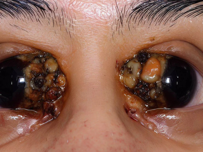 Cheesy AI eyes, UGH!