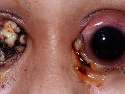 Cheesy AI eyes, UGH!