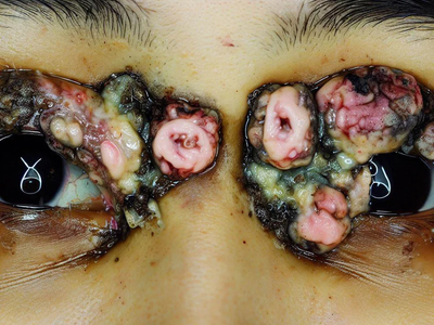 Cheesy AI eyes, UGH!