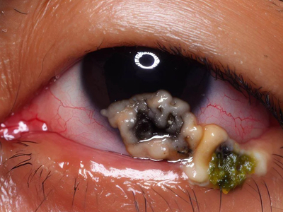 Cheesy AI eyes, UGH!