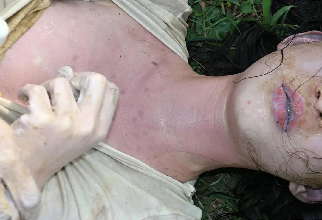 21 Year Old Murder by Drowning Woman Forensic Exam