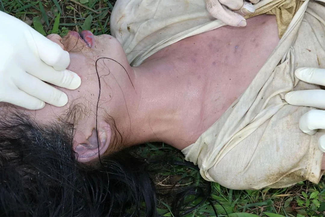 21 Year Old Murder by Drowning Woman Forensic Exam