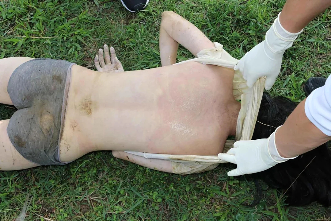 21 Year Old Murder by Drowning Woman Forensic Exam