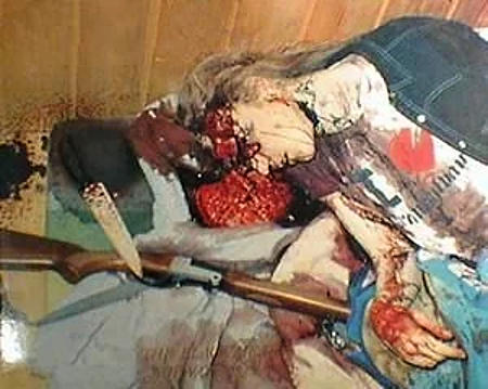 Compilation of shotgun wounds