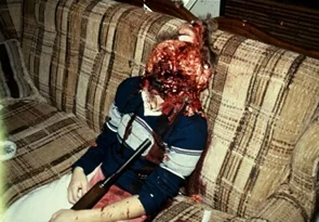 Compilation of shotgun wounds