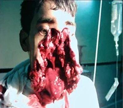 Compilation of shotgun wounds