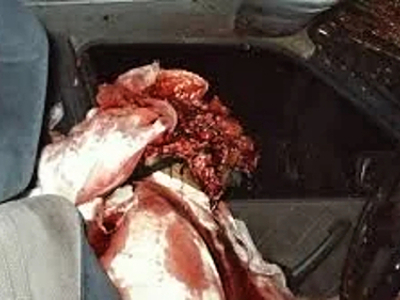 Compilation of shotgun wounds