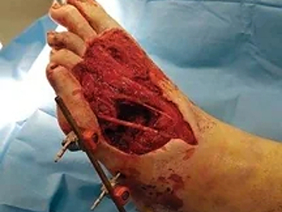 Compilation of shotgun wounds