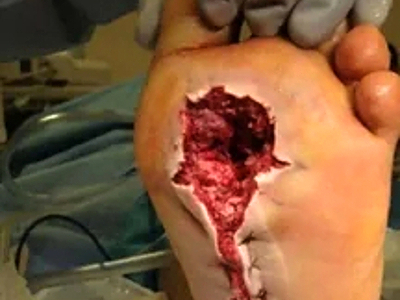 Compilation of shotgun wounds