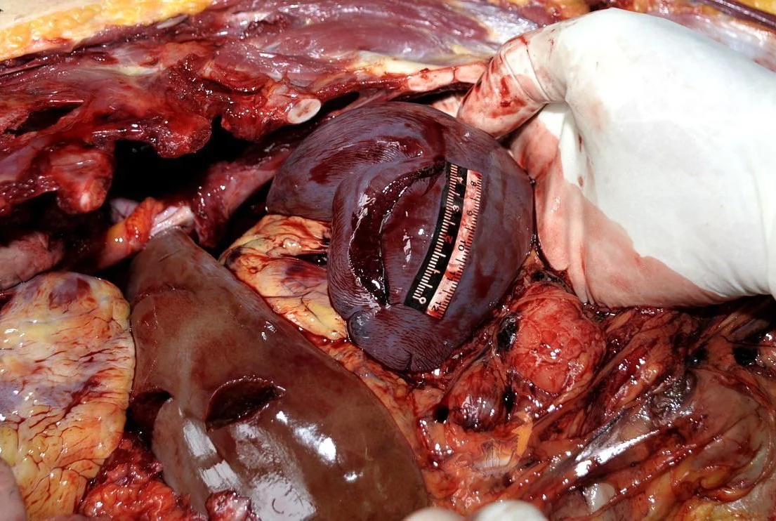 Woman stabbed to death with a partial autopsy at the scene