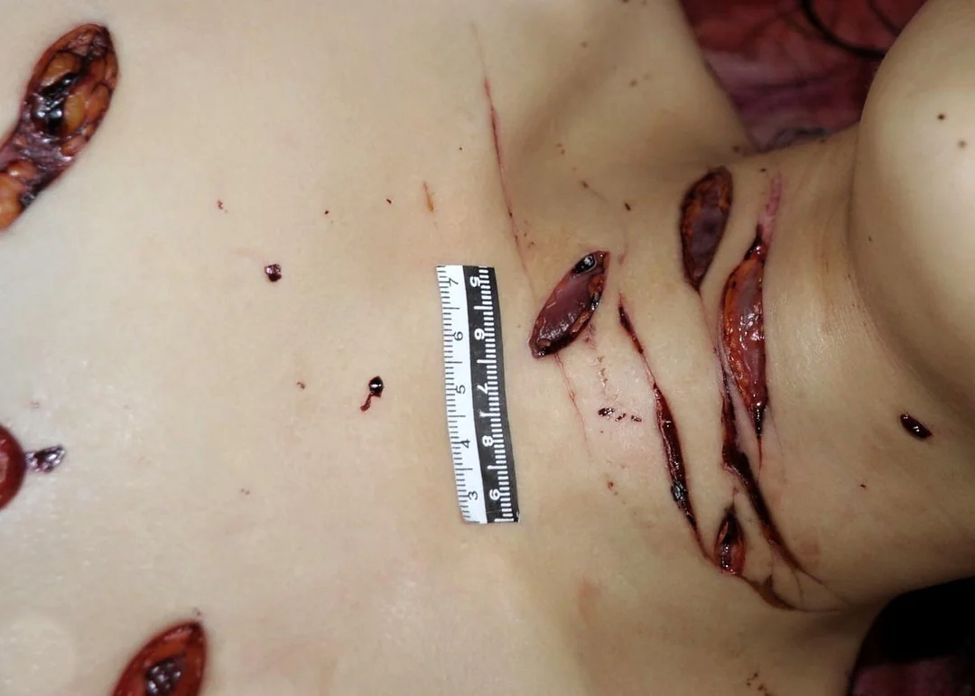 Woman stabbed to death with a partial autopsy at the scene