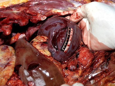 Woman stabbed to death with a partial autopsy at the scene