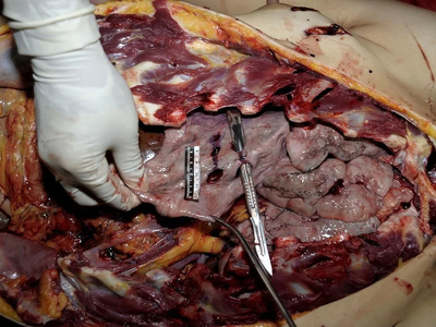 Woman stabbed to death with a partial autopsy at the scene